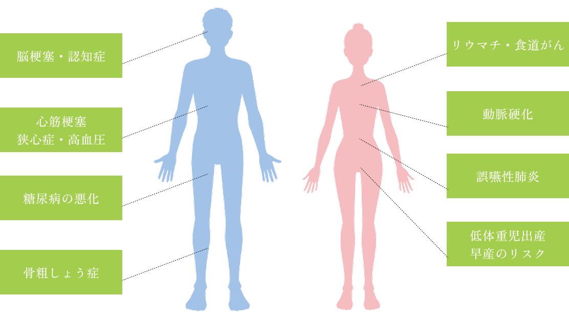 periodontal_sub03_image
